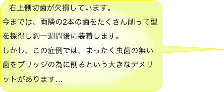 右上側切歯が欠損しています。
今までは、両隣の2本の歯をたくさん削って型を採得し約一週間後に装着します。
しかし、この症例では、まったく虫歯の無い歯をブリッジの為に削るという大きなデメリットがあります…